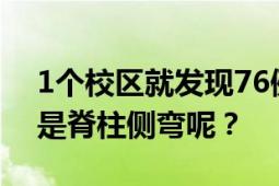 1个校区就发现76例学生脊柱侧弯 怎么判断是脊柱侧弯呢？