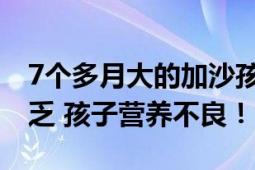 7个多月大的加沙孩子体重只有7斤多 物资匮乏 孩子营养不良！